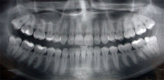 Troy Dental